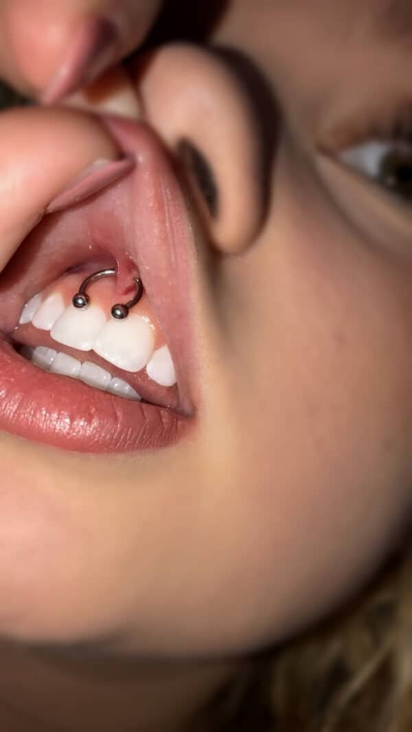 Smiley piercing guide
