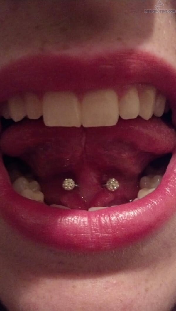 Lingual frenulum piercing picture