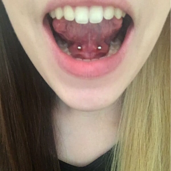 Frenulum Piercing: The Complete Experience Guide!