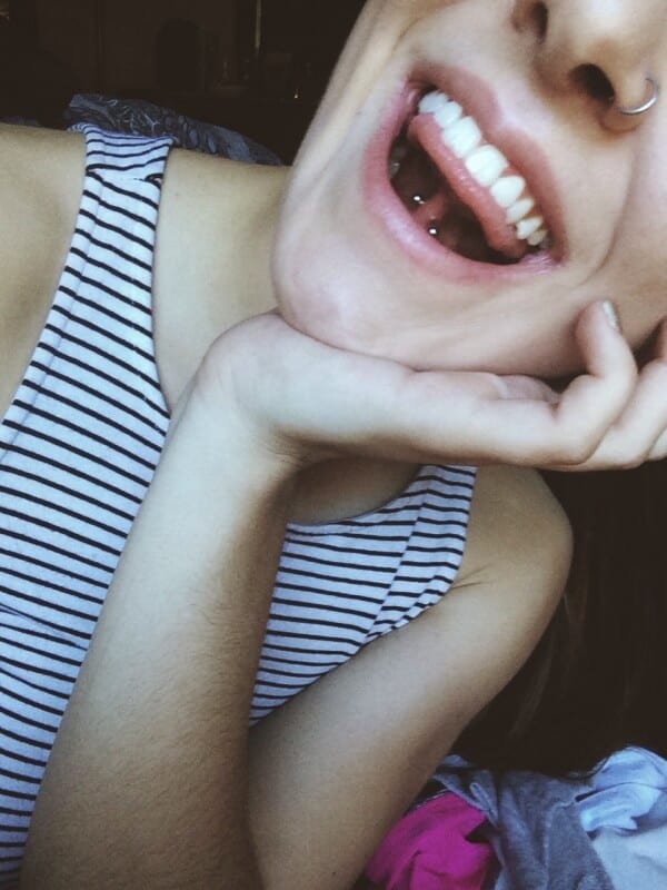 Repierced frenulum