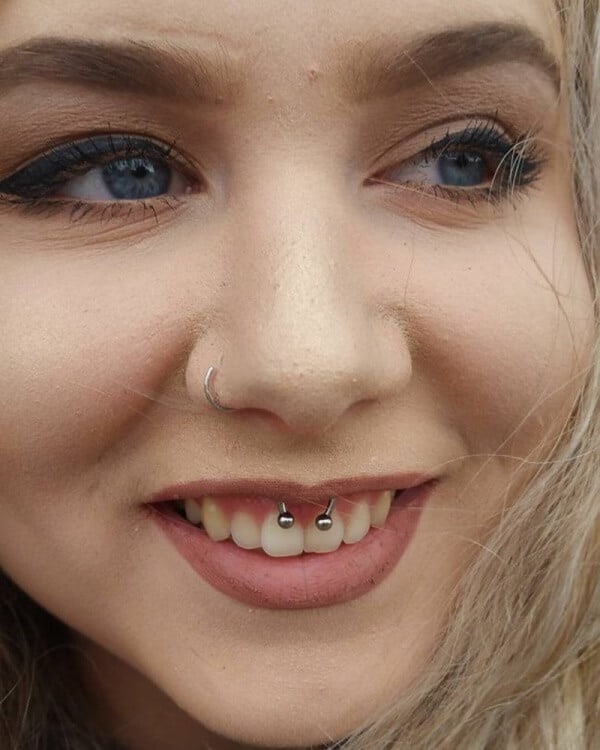 Smiley Piercing