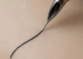 What Does Getting A Tattoo Feel Like