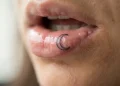 How Long Do Inner Lip Tattoos Last